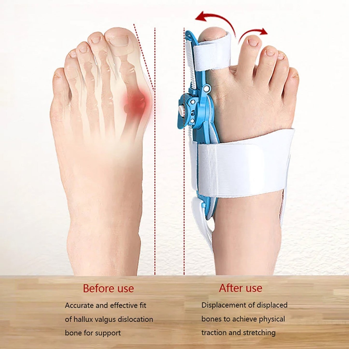 Bunion Support Splint. Valgus And Bunion Valgus, Corrector, Hallux Valgus Corrector, Adjustable Bunion Valgus Protective Cover For Men And Women - Discount Karo