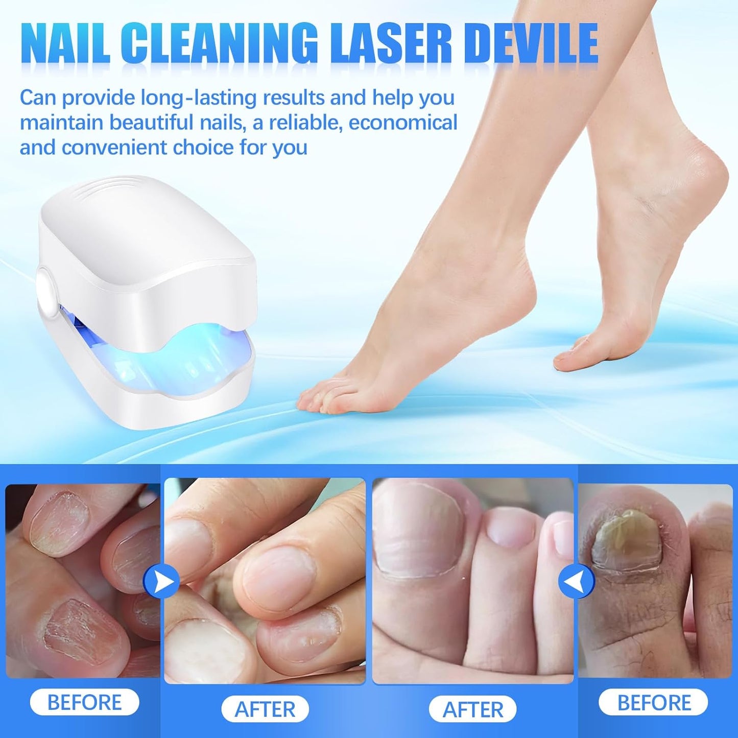 Rechargeable Nail Fungus Treatment for Toenail, Toe Nail Fungal Treatment Nail Fungus Laser Device, Anti-Fungal Nail Treatment for Hand & Feet Infections Remover for Home Use - Discount Karo