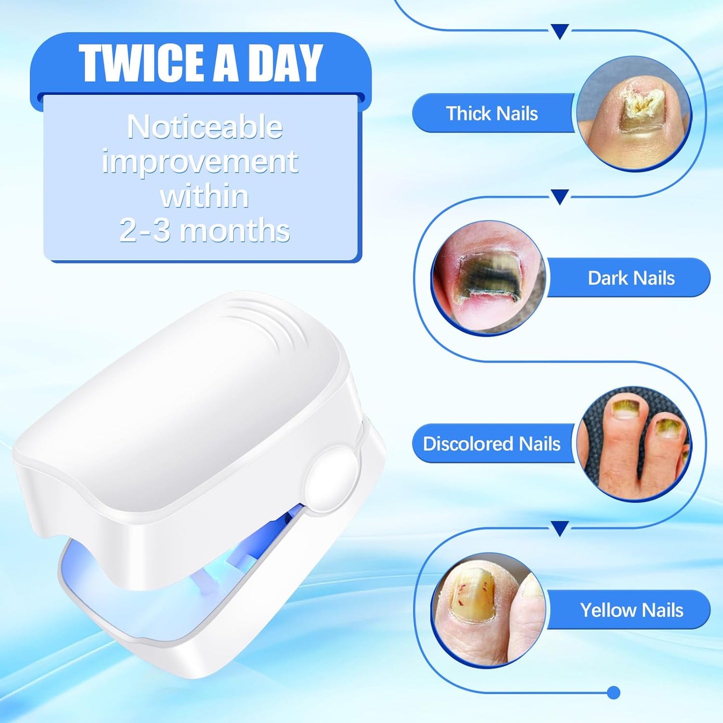 Rechargeable Nail Fungus Treatment for Toenail, Toe Nail Fungal Treatment Nail Fungus Laser Device, Anti-Fungal Nail Treatment for Hand & Feet Infections Remover for Home Use - Discount Karo